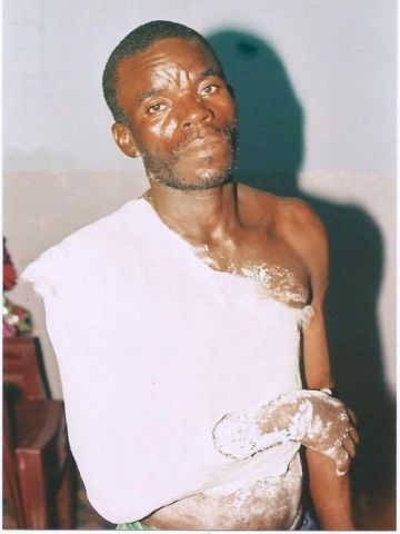  Valentin Ambendé Nguesso abandonne un pauvre agriculteur après l’avoir percuté.